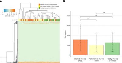 Reduced diversity of intestinal T-cell receptor repertoire in patients with Crohn’s disease